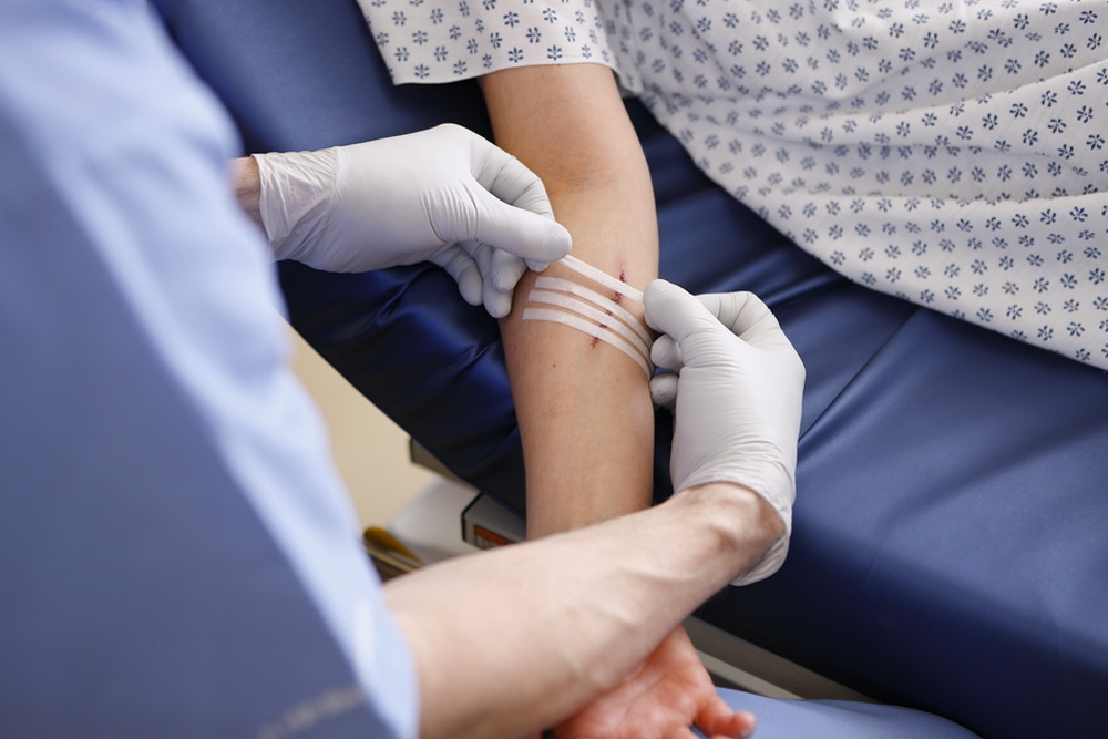 Levulan PhotoDynamic Therapy About Flexile Classic