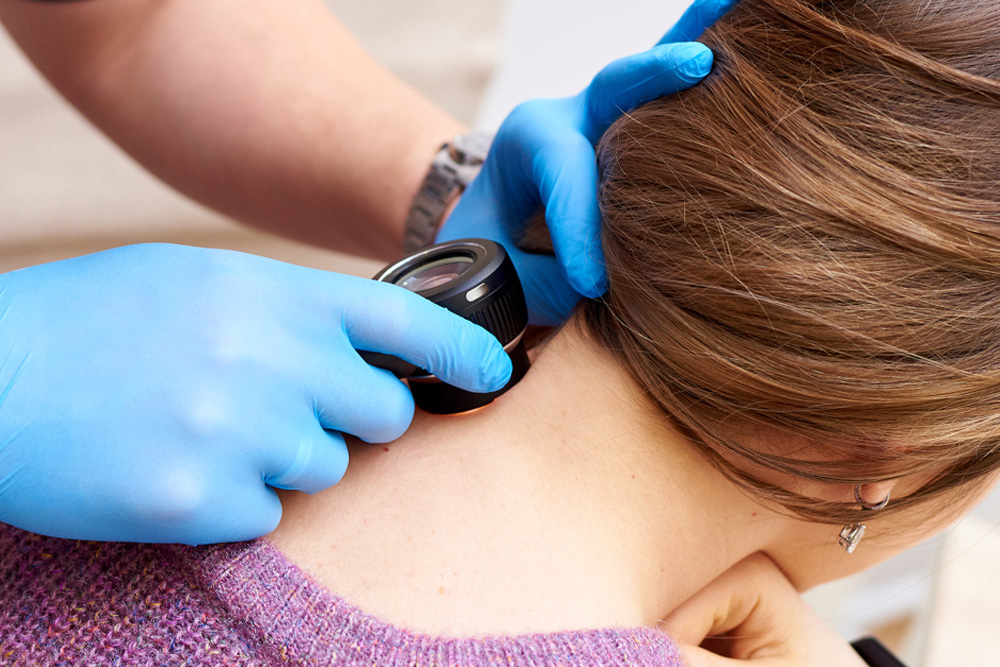 Levulan PhotoDynamic Therapy About Flexile Classic
