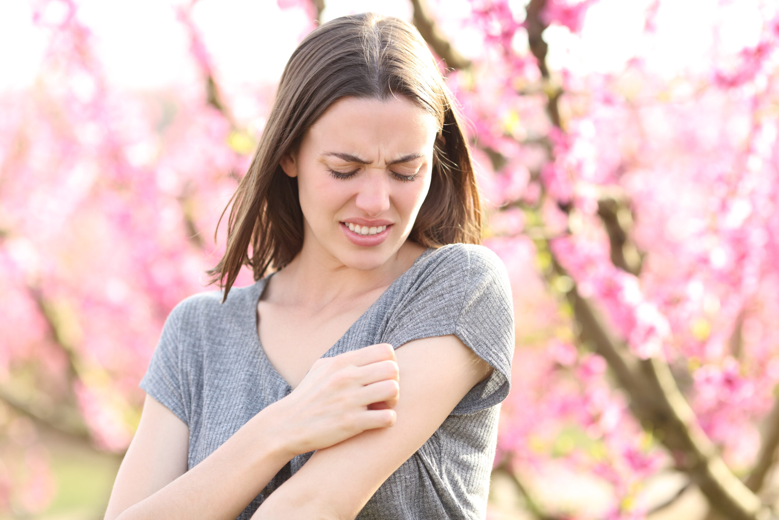 Allergies and Your Skin: How to Manage Springtime Irritations